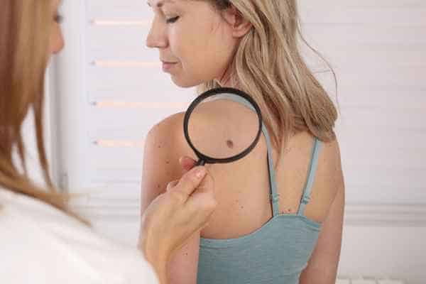 What Are Traditional Skin Lesion Removal Methods Leicester?