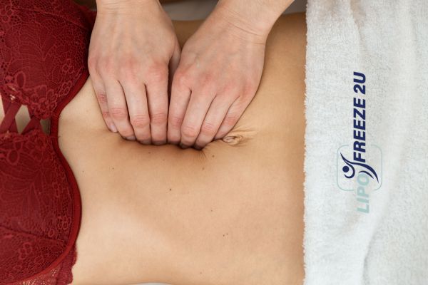diastasis recti treatment Leicester