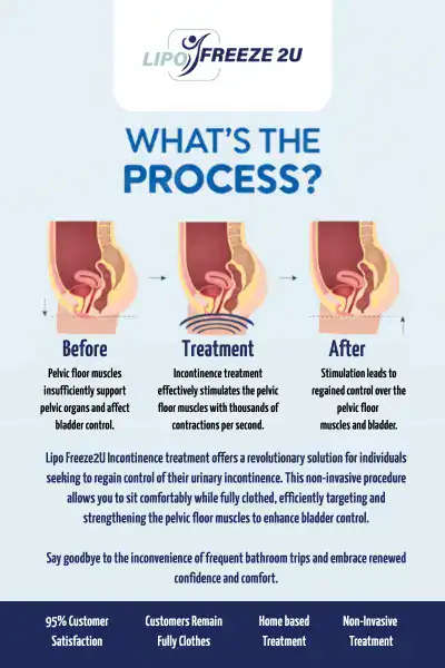 Diagram of how incontinence treatment Leicester works.