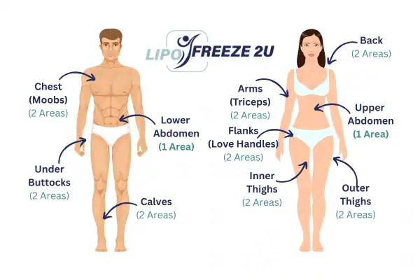 Areas you can have fat freezing treatment Leicester