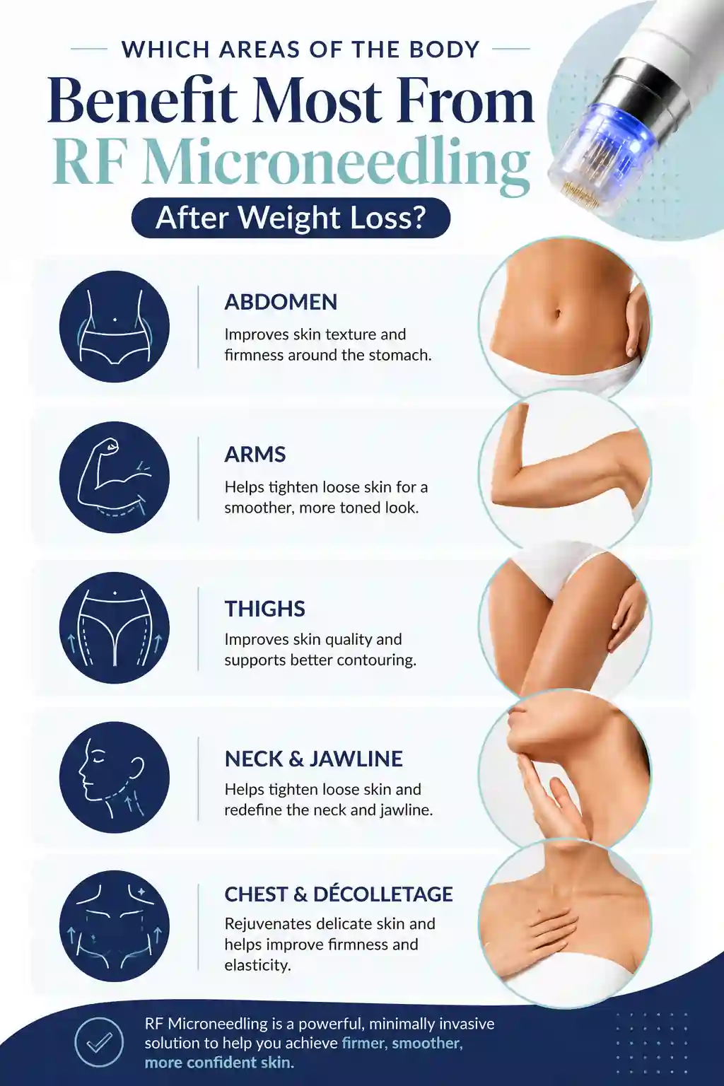Which Areas of the Body Benefit Most From RF Microneedling After Weight Loss Leicester